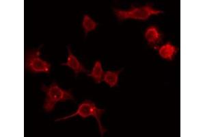 ABIN6274411 staining Hela by IF/ICC. (ADCK2 antibody  (Internal Region))