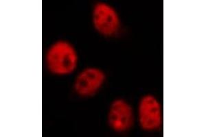 ABIN6269161 staining HeLa by IF/ICC. (CREB1 antibody  (Internal Region))