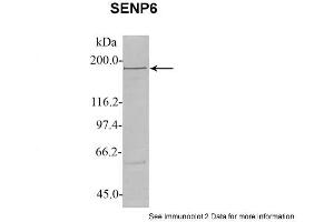 Sample Type: 1. (SENP6 antibody  (C-Term))