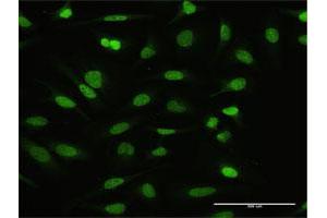 Immunofluorescence of purified MaxPab antibody to NFATC2IP on HeLa cell.