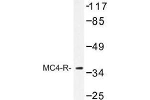 Image no. 1 for anti-Melanocortin 4 Receptor (MC4R) antibody (ABIN317754) (MC4R antibody)