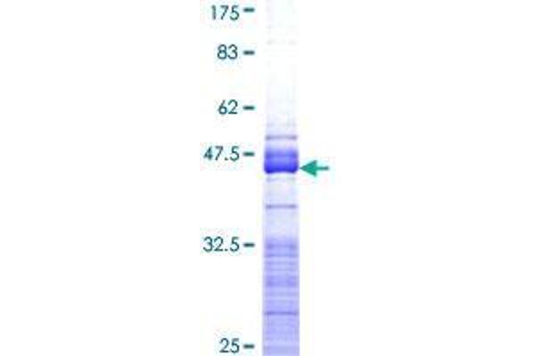 DPYSL5 Protein (AA 466-564) (GST tag)