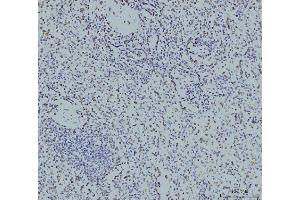 IHC analysis of RPA32/RPA2 using anti-RPA32/RPA2 antibody (ABIN7601379). (RPA2 antibody  (AA 34-254))