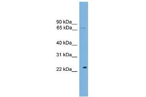 WB Suggested Anti-CALCOCO1 Antibody Titration: 0.
