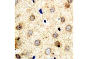 Immunohistochemical analysis of SAR1B staining in human brain formalin fixed paraffin embedded tissue section. (SAR1B antibody)