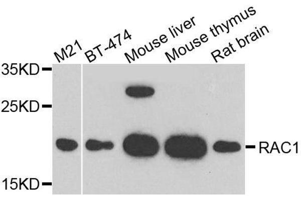 RAC1 antibody  (AA 1-192)