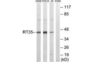Western blot analysis of extracts from Jurkat/COLO/A549 cells, using MRPS35 Antibody. (MRPS35 antibody  (AA 211-260))
