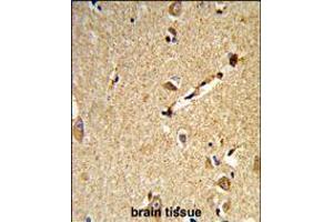 Formalin-fixed and paraffin-embedded human brain tissue reacted with DLL3 Antibody , which was peroxidase-conjugated to the secondary antibody, followed by DAB staining.
