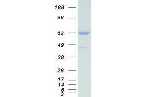 Validation with Western Blot (Sorting Nexin 2 Protein (SNX2) (Myc-DYKDDDDK Tag))