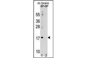 Western Blotting (WB) image for anti-Microtubule-Associated Protein 1 Light Chain 3 alpha (MAP1LC3A) (AA 1-30), (N-Term) antibody (ABIN1449594)