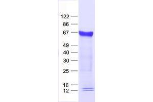 Validation with Western Blot