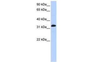 Image no. 1 for anti-Cardiac Troponin T (cTnT) (AA 72-121) antibody (ABIN6743074) (Cardiac Troponin T2 antibody  (AA 72-121))