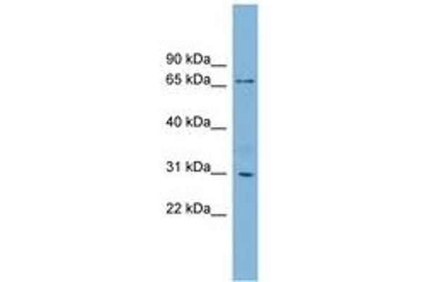 TBCCD1 antibody  (AA 143-192)