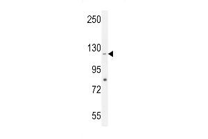 CCDC15 Antibody (C-term) (ABIN655420 and ABIN2844959) western blot analysis in HepG2 cell line lysates (35 μg/lane). (CCDC15 antibody  (C-Term))