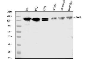 Western blot analysis of ATX2/ATXN2 using anti-ATX2/ATXN2 antibody (ABIN3043507). (Ataxin 2 antibody  (C-Term))