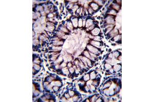 PIGR Antibody immunohistochemistry analysis in formalin fixed and paraffin embedded human colon tissue followed by peroxidase conjugation of the secondary antibody and DAB staining. (Stathmin 1 antibody  (C-Term))