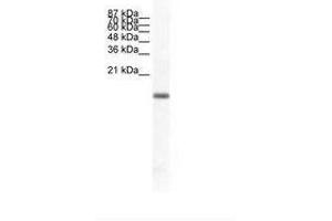 Image no. 1 for anti-Fer3-Like (FERD3L) (N-Term) antibody (ABIN6736019)
