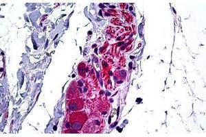 Human Intestine, Ganglion Cells: Formalin-Fixed, Paraffin-Embedded (FFPE) (HDAC6 antibody  (AA 7-56))