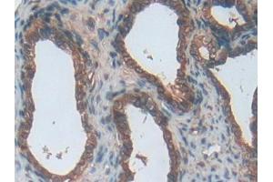 Used in DAB staining on fromalin fixed paraffin- embedded stomach tissue (ENPP1 antibody  (AA 568-793))