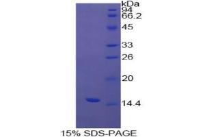 SDS-PAGE analysis of Cow Transthyretin Protein. (TTR Protein)