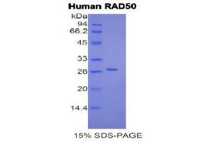 SDS-PAGE (SDS) image for RAD50 Homolog (S. Cerevisiae) (RAD50) (AA 400-595) protein (His tag) (ABIN1170340) (RAD50 Protein (AA 400-595) (His tag))