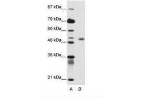 Image no. 1 for anti-Deformed Epidermal Autoregulatory Factor 1 (Drosophila) (DEAF1) (C-Term) antibody (ABIN6736145) (DEAF1 antibody  (C-Term))