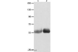 Western blot analysis of Human liver cancer and stomach cancer tissue , using MUTYH Polyclonal Antibody at dilution of 1:1000 (MUTYH antibody)