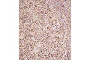 Immunohistochemical analysis of B on paraffin-embedded Human tonsil tissue. (RECQL4 antibody  (C-Term))