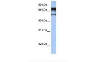 Image no. 1 for anti-Zinc Finger Protein 780B (ZNF780B) (AA 74-123) antibody (ABIN6739279)