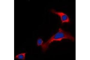 Immunofluorescent analysis of DOK6 staining in COLO205 cells. (DOK6 antibody)
