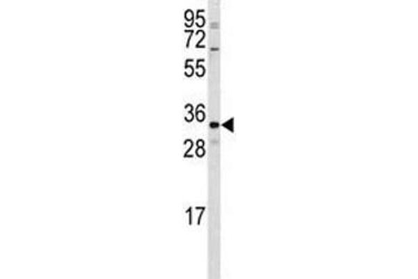 CTDSP2 antibody  (AA 12-42)