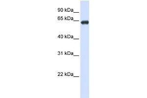 WB Suggested Anti-SLC39A4 Antibody Titration:  0.