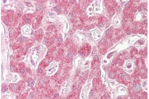 Anti-SIN1 antibody IHC staining of human liver. (MAPKAP1 antibody  (AA 100-150))
