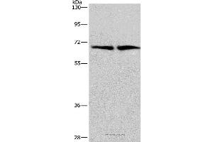 Western blot analysis of Human brain malignant glioma and bladder carcinoma tissue, using CDK5RAP3 Polyclonal Antibody at dilution of 1:449 (CDK5RAP3 antibody)