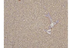 IHC analysis of CYP2C19 using anti-CYP2C19 antibody (ABIN6719471).