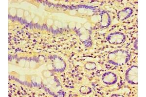 Immunohistochemistry of paraffin-embedded human small intestine tissue using ABIN7157760 at dilution of 1:100 (CCBL1 antibody  (AA 1-372))