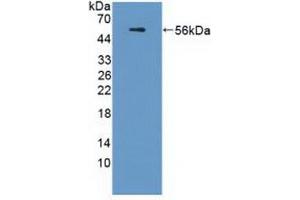 Detection of Recombinant APOL1, Human using Polyclonal Antibody to Apolipoprotein L (APOL1) (APOL1 antibody  (AA 1-238))