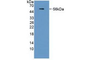 Detection of Recombinant APOL1, Human using Polyclonal Antibody to Apolipoprotein L (APOL1) (APOL1 antibody  (AA 1-238))