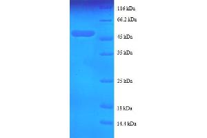 Tumor Necrosis Factor, alpha-Induced Protein 8 (TNFAIP8) (AA 2-198), (full length) protein (GST tag) (TNFAIP8 Protein (AA 2-198, full length) (GST tag))