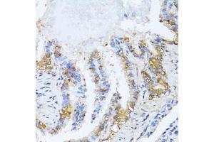 Immunohistochemistry of paraffin-embedded rat lung using N antibody (ABIN6132387, ABIN6144378, ABIN6144379 and ABIN6216511) at dilution of 1:100 (40x lens). (NAT2 antibody  (AA 171-290))