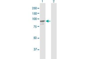 PLOD2 antibody  (AA 1-758)