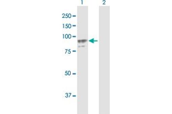 PLOD2 antibody  (AA 1-758)