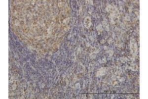 Immunoperoxidase of monoclonal antibody to CDKL4 on formalin-fixed paraffin-embedded human lymph node. (CDKL4 antibody  (AA 196-295))
