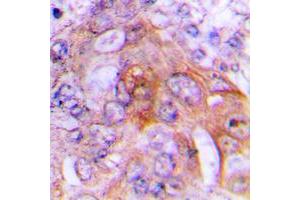 Immunohistochemical analysis of HADH2 staining in human lung formalin fixed paraffin embedded tissue section. (HSD17B10 antibody  (Center))