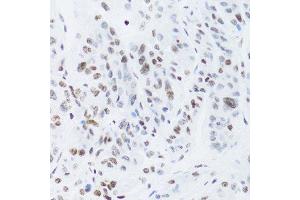 Immunohistochemistry (Paraffin-embedded Sections) (IHC (p)) image for anti-Nuclear Factor of kappa Light Polypeptide Gene Enhancer in B-Cells 2 (NFKB2) (AA 690-899) antibody (ABIN3017388)