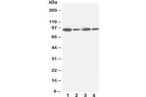 Western blot testing of FES antibody and Lane 1:  HeLa;  2: 293T;  3: SKOV;  4: A549 lysate. (FES antibody  (C-Term))