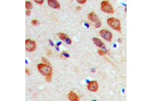 Immunohistochemical analysis of RPL22 staining in human brain formalin fixed paraffin embedded tissue section. (RPL22 antibody  (Center))