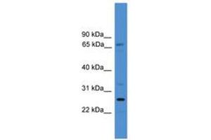 Image no. 1 for anti-Solute Carrier Family 13 Member 3 (SLC13A3) (AA 400-449) antibody (ABIN6745414) (SLC13A3 antibody  (AA 400-449))