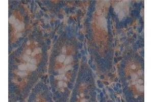 Detection of BFP in Rat Intestine Tissue using Polyclonal Antibody to Brain Finger Protein (BFP) (RNF112 antibody  (AA 256-504))