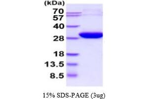 SDS-PAGE (SDS) image for Enoyl CoA Hydratase, Short Chain, 1, Mitochondrial (ECHS1) (AA 28-290) (Active) protein (His tag) (ABIN6388011) (ECHS1 Protein (AA 28-290) (His tag))